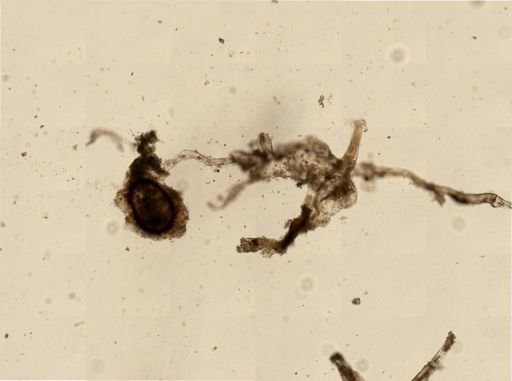 Pottsiella erecta