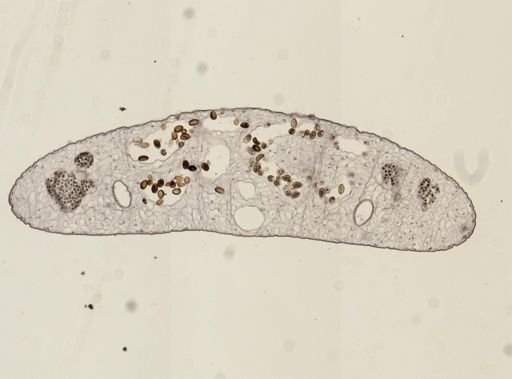 Dicrocoelium dendriticum