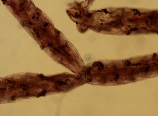 Elzerina blainvillii