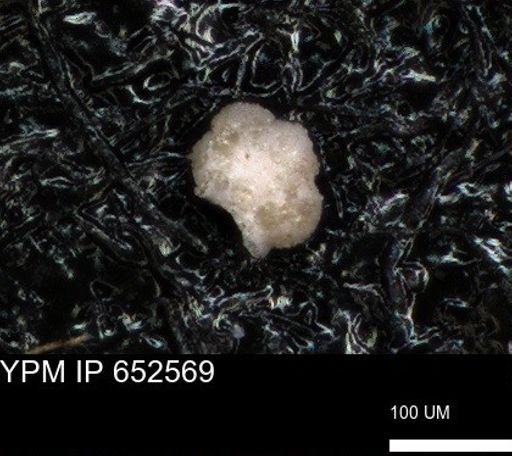 undet. Foraminiferida