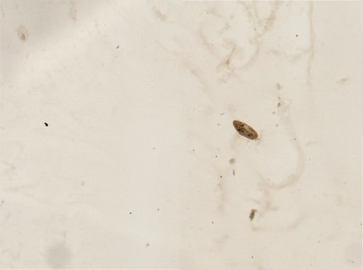 Paramecium