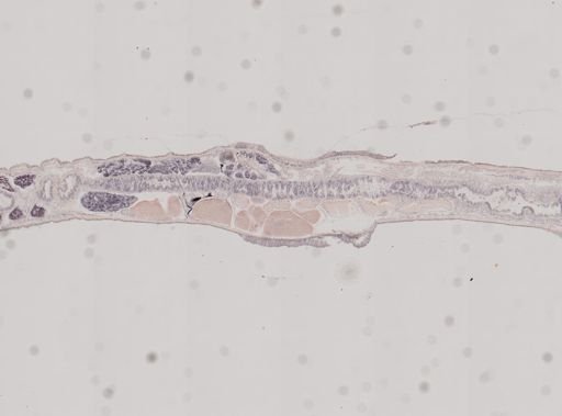 Enchytraeidae