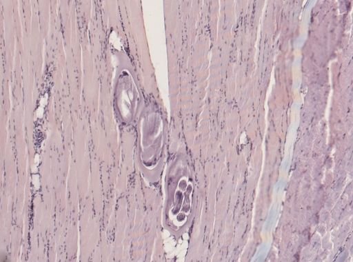 Trichinella spiralis