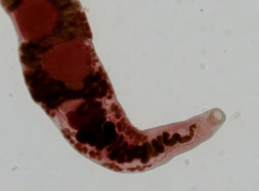 Haematoloechus medioplexus