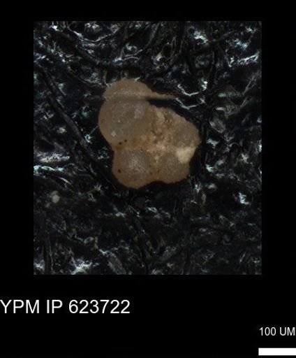 undet. Rugoglobigerinidae