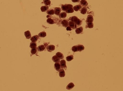 Echinococcus granulosus