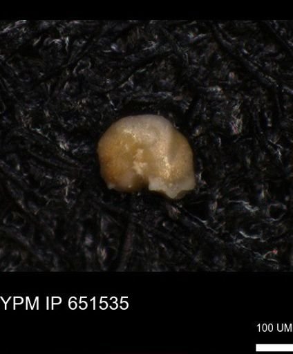 undet. Foraminiferida