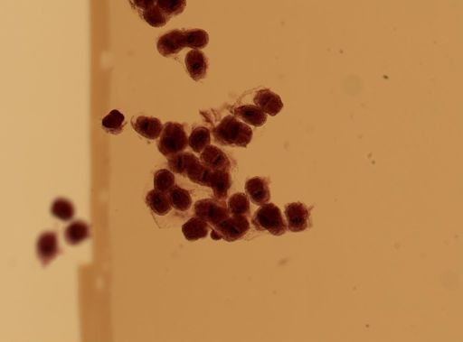 Echinococcus granulosus