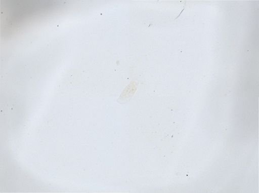 Woodruffia metabolica