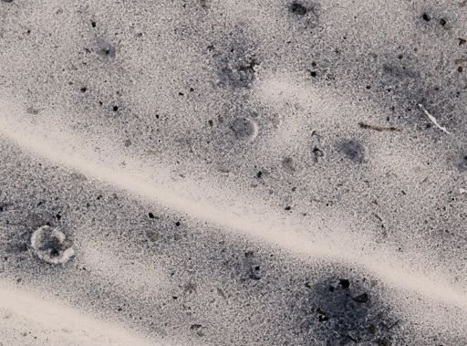 Dientamoeba fragilis