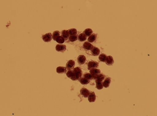Echinococcus granulosus