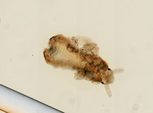 Pediculus humanus