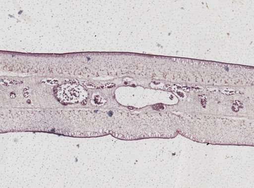 Taenia saginata