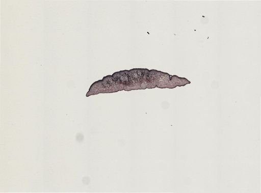 Foviella