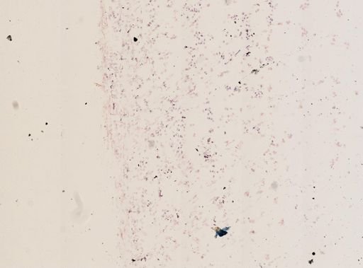 Trypanosoma diemyctyli