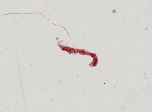 Trematoda