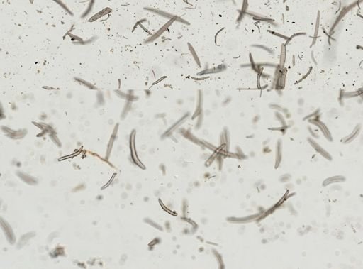 Holothuroidea