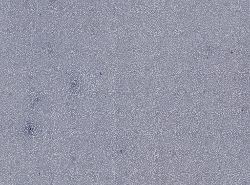 Plasmodium vivax