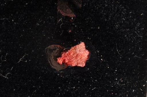 Bryozoa