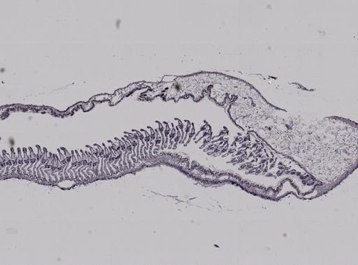 Crepidula fornicata