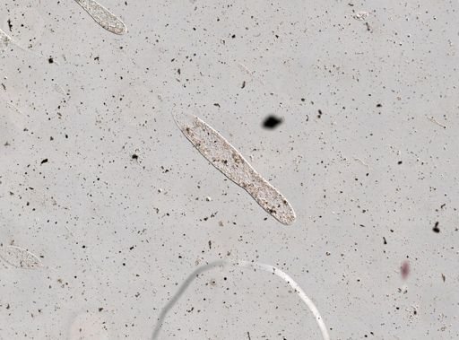 Trypanosoma?