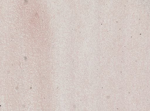 Plasmodium falciparum