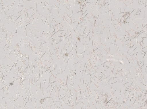 Isodictya deichmannae