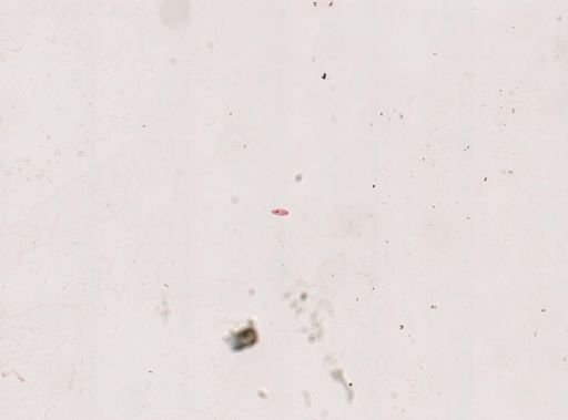 Paramecium