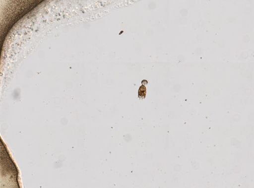 Keratella cochlearis tecta