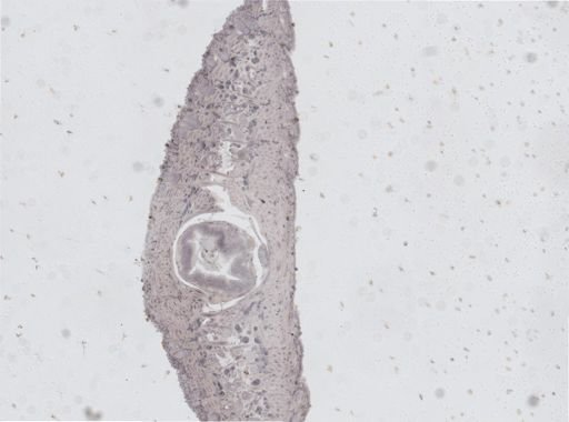 Glossiphonia