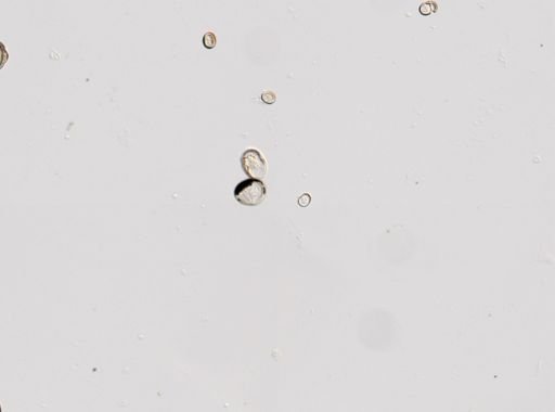 Cestoda