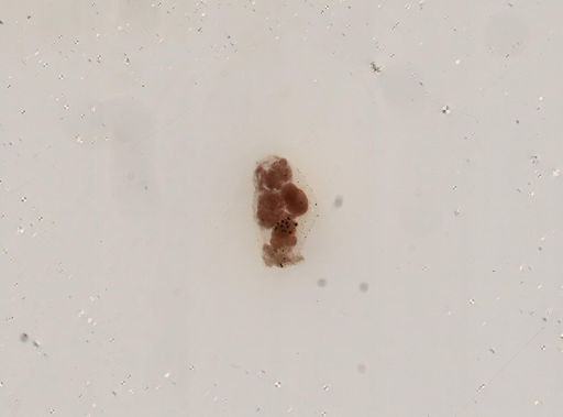 Asplanchna sieboldii
