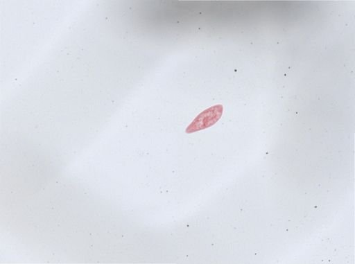 Paramecium aurelia