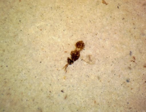 undet. Hymenoptera
