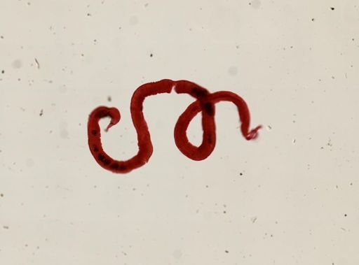 Protodrilus