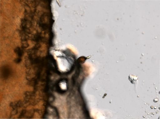 Ploesoma truncatum