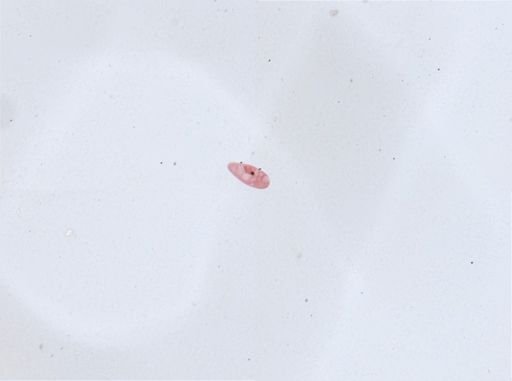 Paramecium aurelia