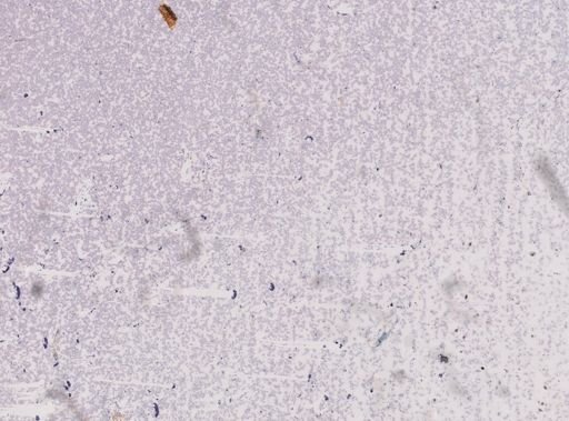 Trypanosoma equinum