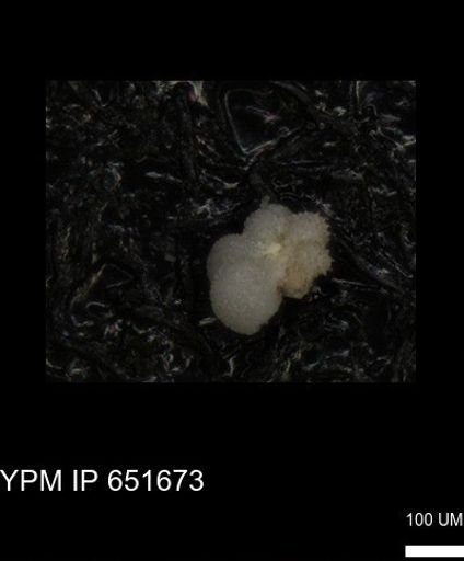 undet. Rugoglobigerinidae