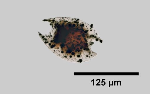 Lepadella parasitica