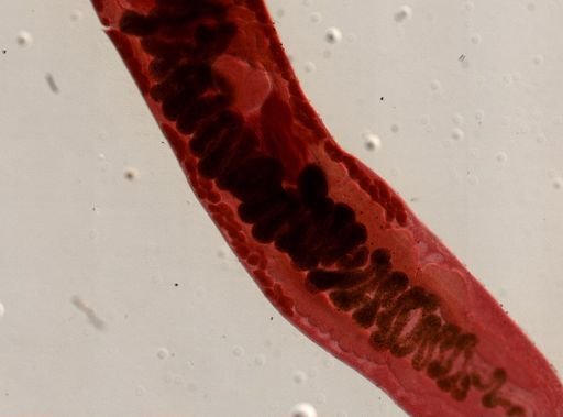 Platyhelminthes