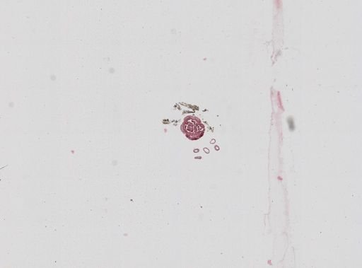 Nematostella