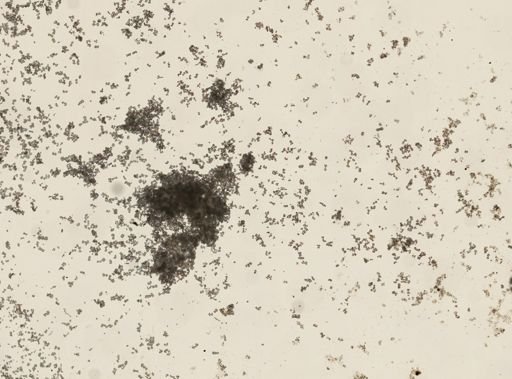 Actinopyga echinites