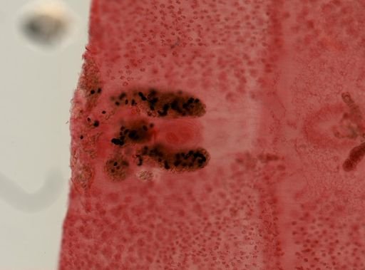 Diphyllobothrium latum