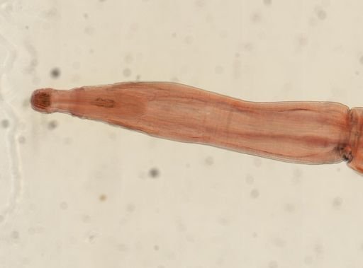Oligacanthorhynchus microcephalus