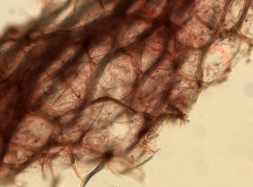cf. Dasychalina