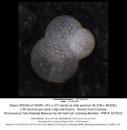 undet. Foraminiferida