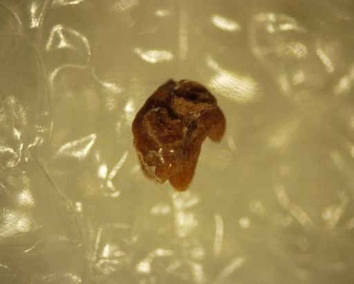 Adapisoricidae sp.