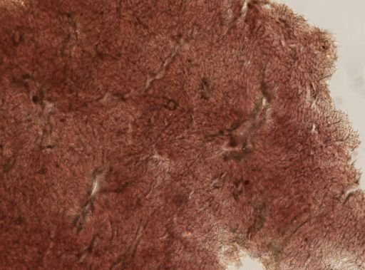 Plakortis sp.