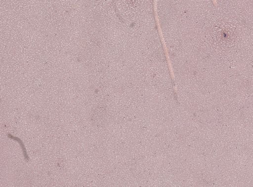 Plasmodium falciparum